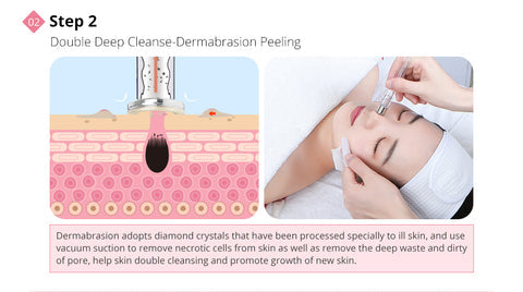 ComplexCity Microdermabrasion Microcurrent Photon Beauty Device