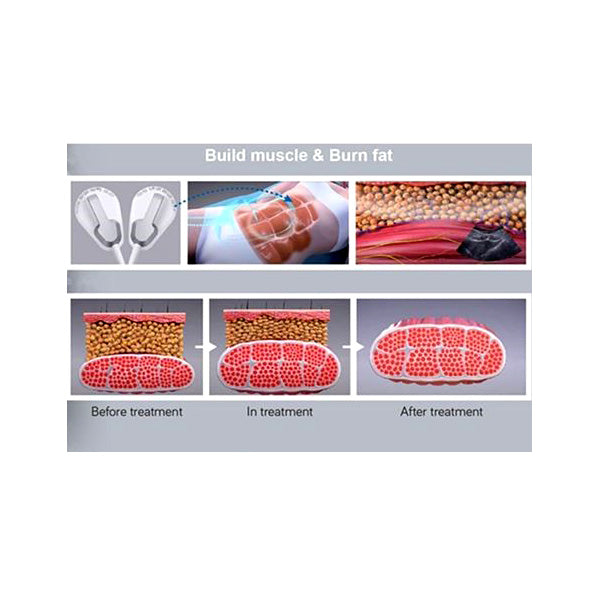 EMS Perfect Sculpt 4